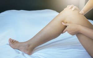 Нарушение венозного кровотока в ногах