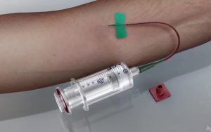 Naujos kartos dviejų švirkštų sistema Arthrex ACP® Double Syringe